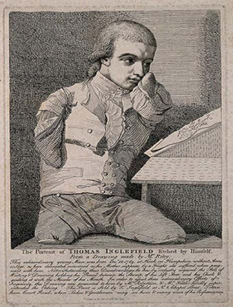 An 18th-century black-and-white etching of Thomas Inglefield, a young man born without arms or legs, shown seated with a stump of an arm resting near a drawing on a slanted table. The detailed caption beneath describes his life and how he produced art by holding a pencil with his left arm stump and guiding it with his mouth.